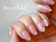 ブレスネイル(brace Nail)の写真