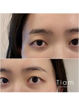 ティアム(TIAM)/左右差もご相談ください☆