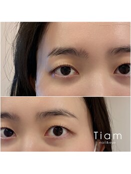 ティアム(TIAM)/左右差もご相談ください☆