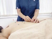 アキュモード鍼灸院 表参道