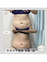 カラー(CALLA)/ウルトラ痩身☆お腹