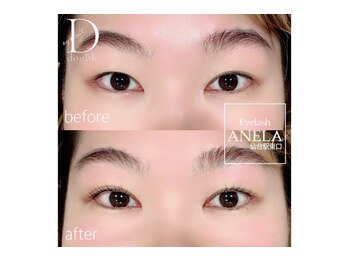 アネラ 仙台駅東口店(ANELA)/ダブルアイリフト