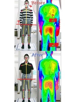 姫路なごみ整体院 なごみ鍼灸院/(改善例)右肩甲骨の痛み
