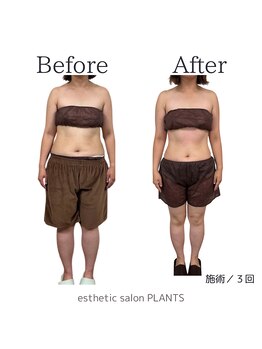 プランツ(PLANTS)/30代／３回／お腹ケア・腸活