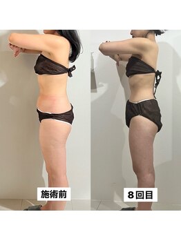 インナーメス(INNER MES)/全身徹底痩身!