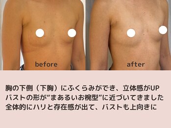 ナニキョウト(nani kyoto)/ビフォーアフター