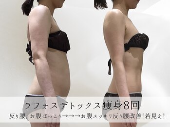 ミヨンラボ(miyon LABO)/ラフォスデトックス痩身8回