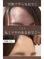 ソナ 大和西大寺院(SONA)&nbsp;汚肌とぺたんこおでこから、ツヤのある丸みを帯びたおでこへ♪