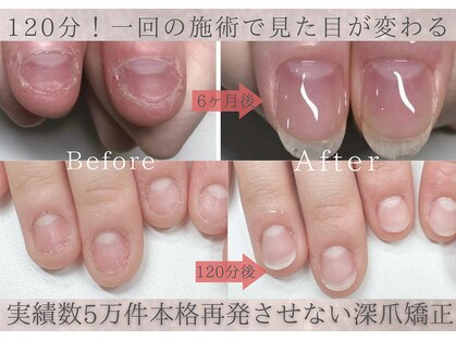 ティアラネイル 宇都宮の写真