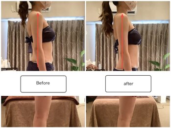 スラン(Slan)/巻き肩改善