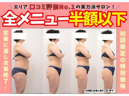 インナーメス(INNER MES)の写真