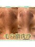 【毛穴が汚すぎる】GW徹底洗浄＋毛穴レス美肌♪ディープ・ハイドロホワイト