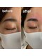 ソラン(SORAN)の写真/【大人の垢抜け美眉♪】HBLハリウッドブロウリフトで毛流れを整え、理想の眉へ