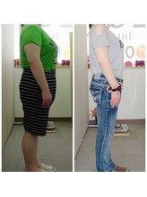 耳つぼアンドスリムケア イヤローブ(Earlobe)/16.8kg減！！(5ヶ月)