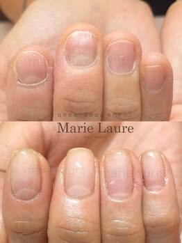 マリーロール 梅田店(Marie Laure)/深爪矯正/自爪育成/自爪風