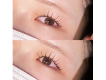 アイラ 川口店/[ LED施術 ]×upワードラッシュ