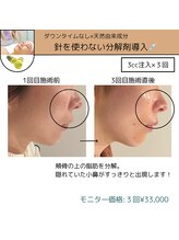 ミーカラー(mecalla.)/レモンボトルBA