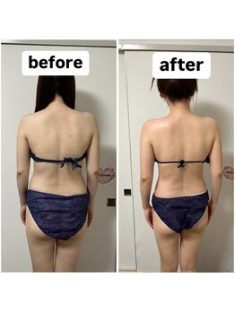 きれい塾 恵比寿/6回目の施術結果