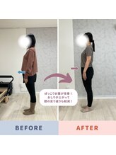 Nピラティス 横浜店/難しい反張膝もお任せ！