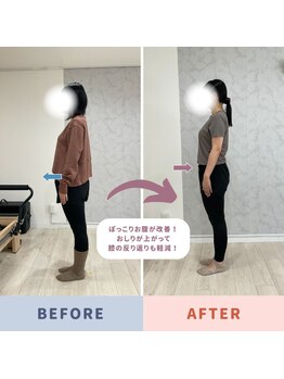 Nピラティス 横浜店/難しい反張膝もお任せ!