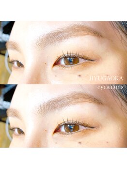 ジユウガオカ アイサロンズ by G.M.NeXT 二子玉川店(JIYUGAOKA eye salons)/EGUTAM使用二ヶ月後..!