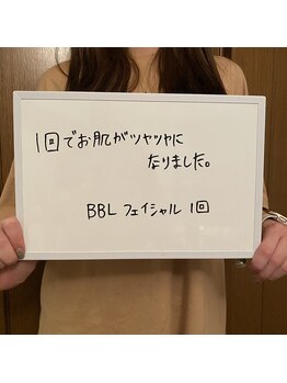 リノ(Lino)/お客様の声★
