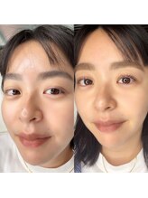 アンドミー(&me)/オーダーメイドリフト×フラット