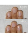 自爪ケア＋光沢仕上げ