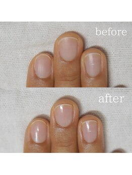 自爪ケア＋光沢仕上げ