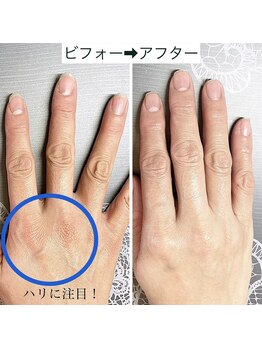 桃の木 吉祥寺店/ハンドケアは効果がわかりやすい