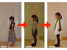 リファイン(Refine)/成長期の女の子の姿勢変化