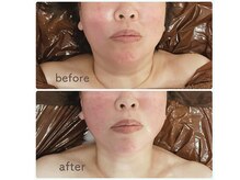 モリコ コンフィデントビューティーサロン(Moriko Confident Beauty Salon)の雰囲気（1回でも顔まわりスッキリ）