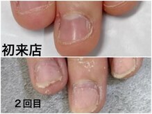 グレースレディ 神戸北店/