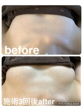 ギンザアール(GINZA R.)/理想のバストに◎