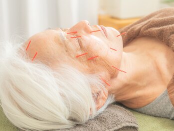 かけこみでら/美容鍼　首肩ケア・頭マッサージ