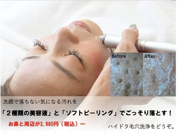 デュポン 東松山店(Dupont)/大人気毛穴洗浄