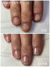 ネイルブルームーン(Nail Blue Moon)/最強ネイルケアコース