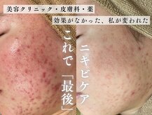 サロンドレナ 栄店