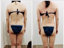 アイディエム 新宿店(IDM)/【モニター】165ｃｍ・３０代