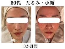 ランティル(l’until)の雰囲気（小顔・たるみ・毛穴悩みを改善。鏡を見るのが楽しみになる毎日に）