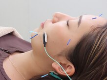 ゆしんアネックスの雰囲気（医学博士が監修の、お顔に微弱な電気を流す美容鍼です。）
