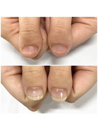 自爪育成コース