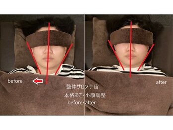 整体サロン宇宙/☆本格あご・小顔矯正☆
