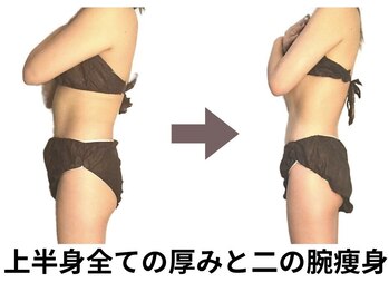 ニュートラル 池袋店(NEUTRAL)/施術結果【痩身/筋膜】
