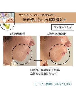 ミーカラー(mecalla.)/レモンボトルBA