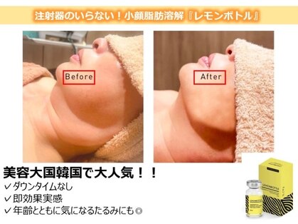 クオーレ(cuore)の写真
