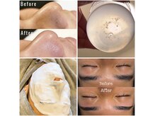 サロン アヌエヌエ アンド ポノ サロン(SalonAnuenue&pono_salon)の雰囲気（美眉waxスタイリング＋顔全体毛穴洗浄◎美眉&黒ずみ除去◎）