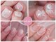 ネイルグロウ(NAIL GLOW)の写真