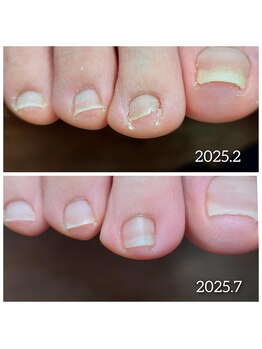 爪切り屋 足楽/