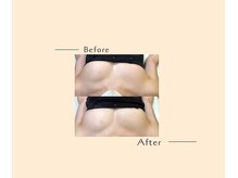 オベリオ(OBERIO)/